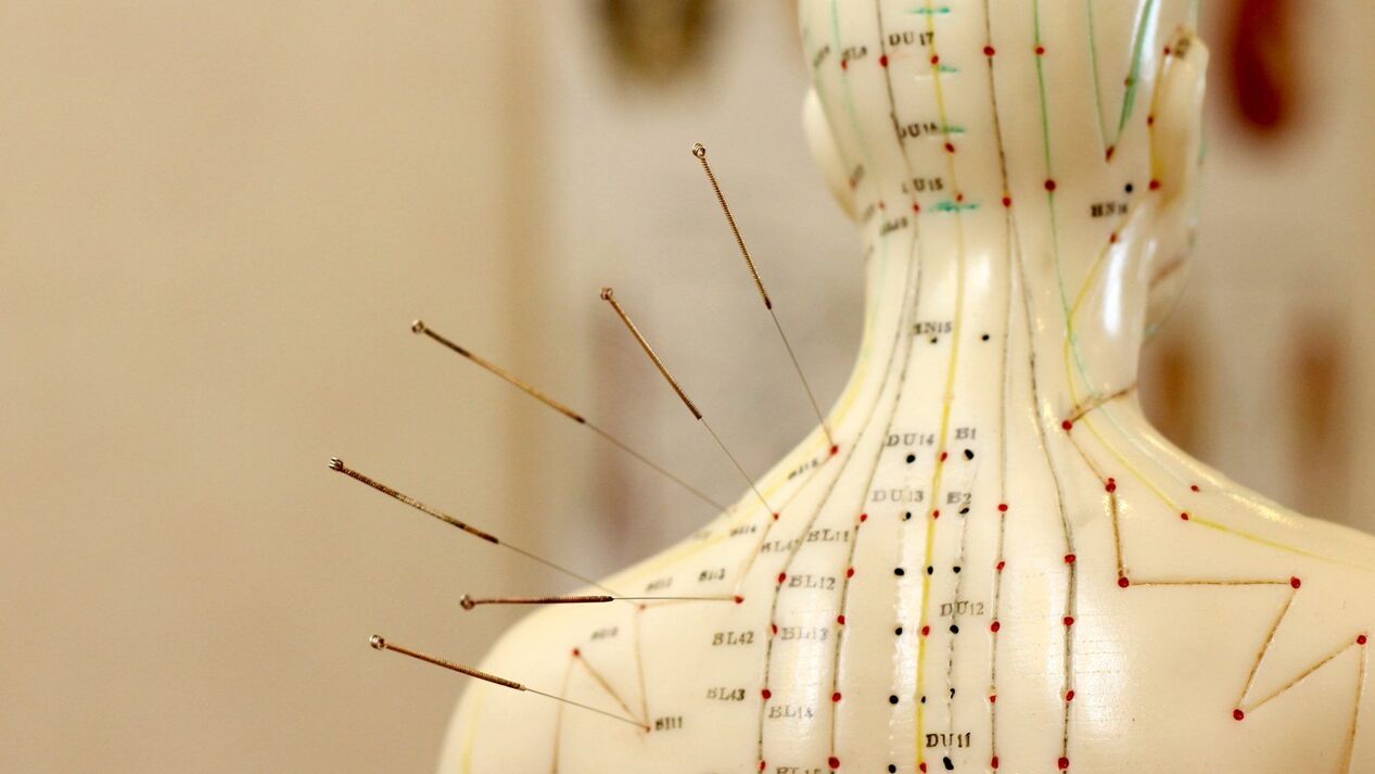 Akupunktūra nuo gimdos kaklelio osteochondrozės