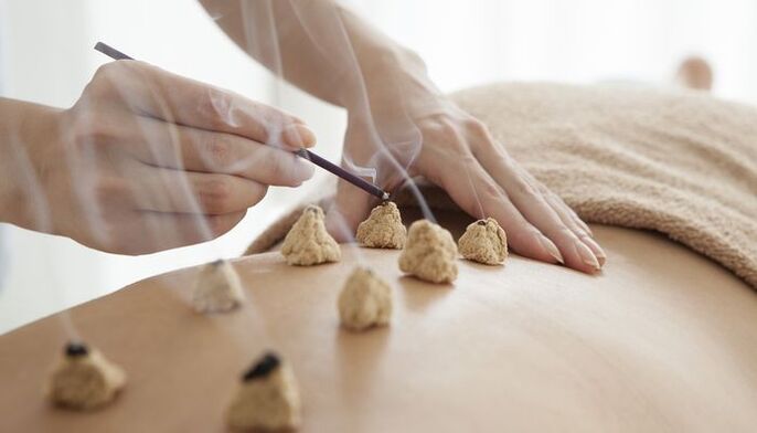 Bioaktyvių taškų apšilimas ant nugaros osteochondrozei